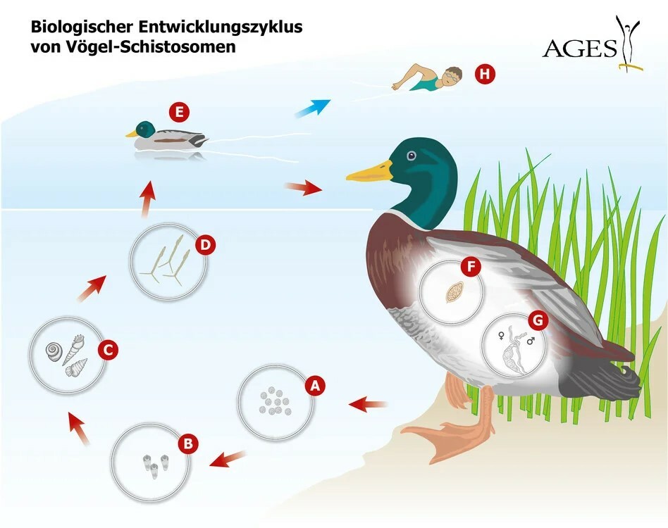 Zerkariendermatitis; Quelle: AGES